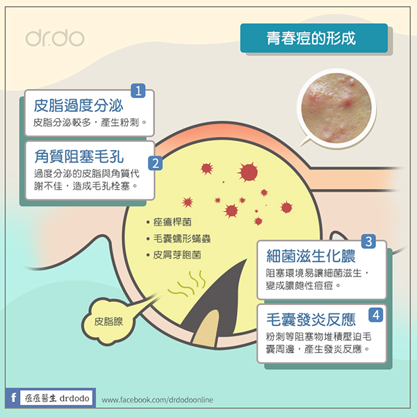 海菲秀HydraFacial（水飛梭）