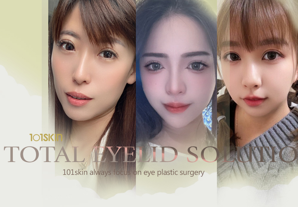 提眼肌矯正手術